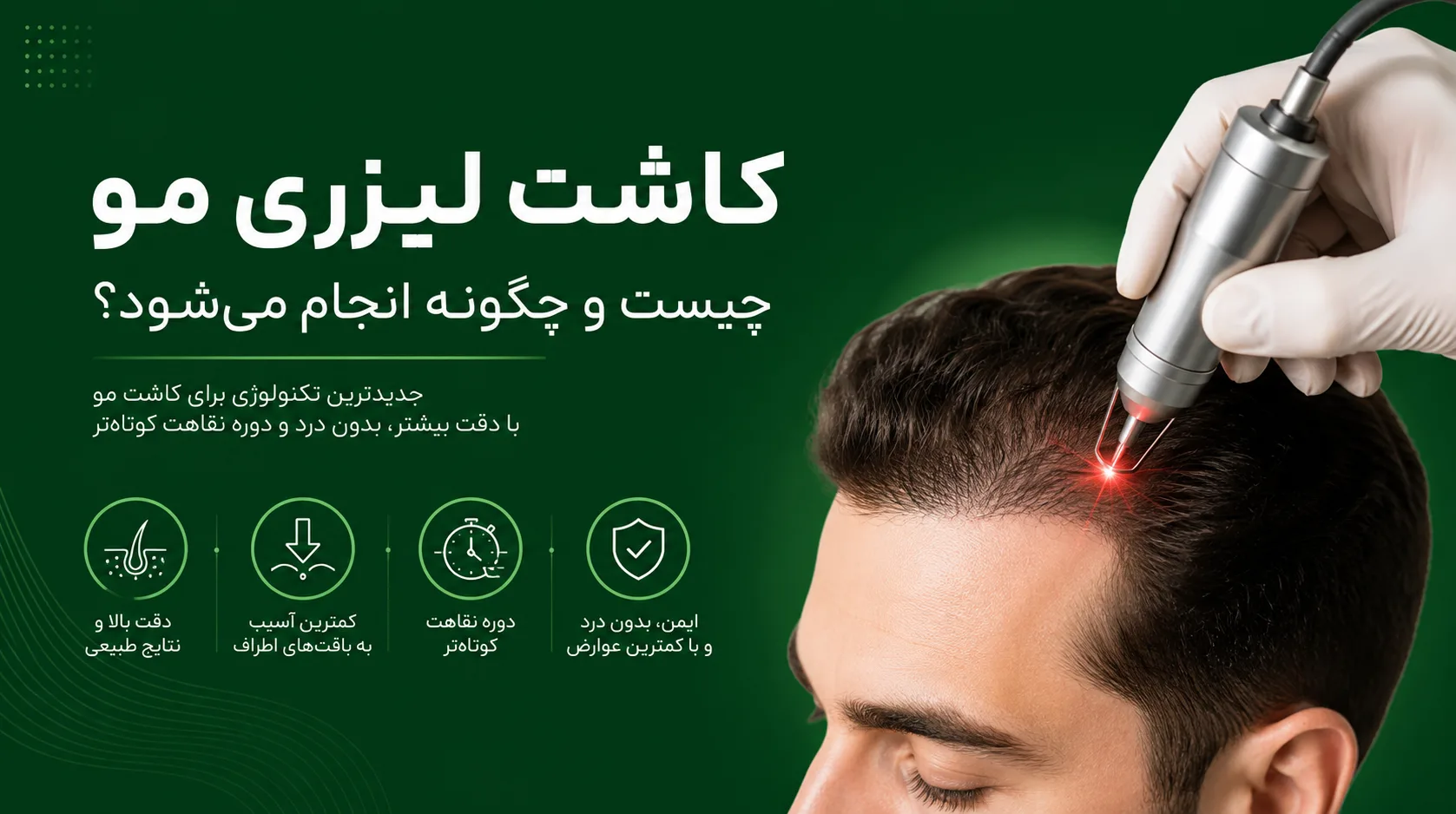 کاشت مو لیزری چیست و چگونه انجام می شود